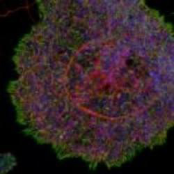 Image for disease modeling