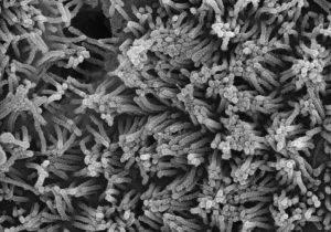 Scanning electron microscope image of himan microvilli