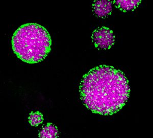 Reconstituted Pickering Emulsion (MEG-3 solid clusters, green; PGL-3 liquid core, magenta)